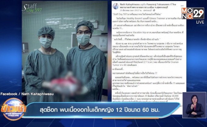 สุดช็อก พบเนื้องอกในเด็กหญิง 12 ปีขนาด 60 ซม.