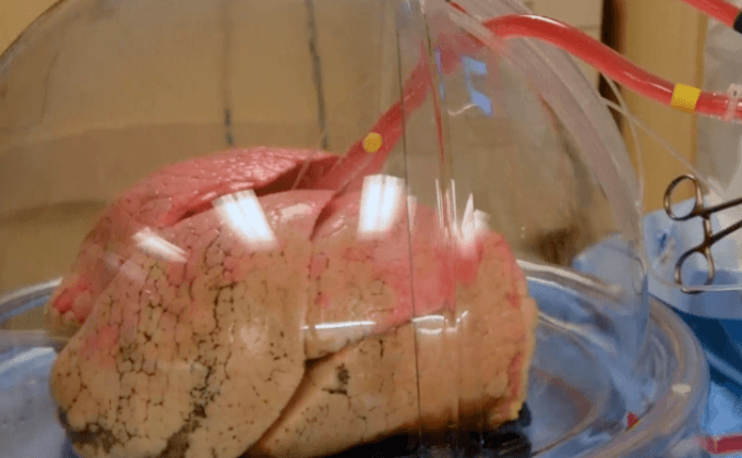 เครื่องฟื้นฟูปอดนอกร่างกาย