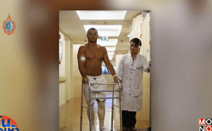 นักยิมนาสติกฝรั่งเศสเดินแล้วหลังผ่าตัดขาที่หัก