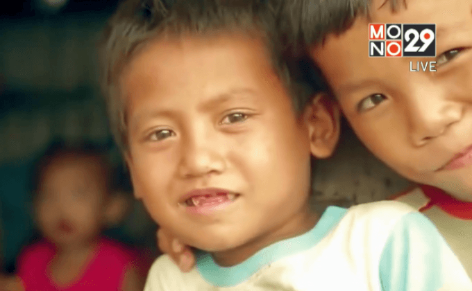 เด็กฟิลิปปินส์ 1 ใน 3 อยู่ในภาวะแคระแกร็น