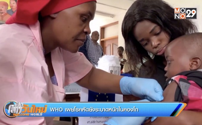 WHO เผยโรคหัดยังระบาดหนักในคองโก