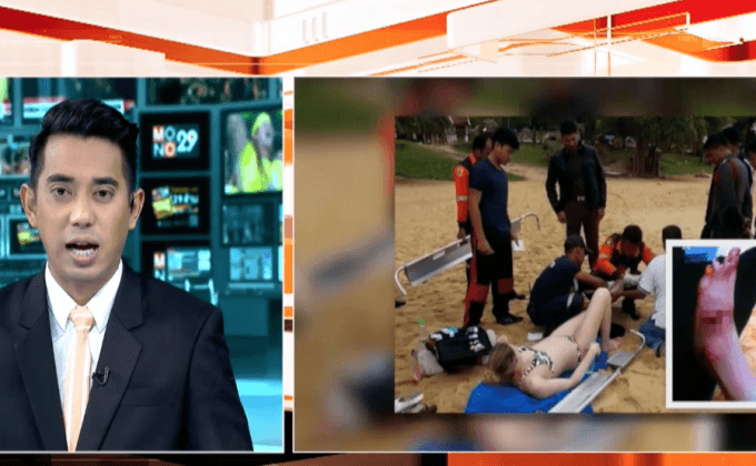 สัตว์ทะเลไม่ทราบชนิดกัดนักท่องเที่ยวที่หาดกะรน ภูเก็ต