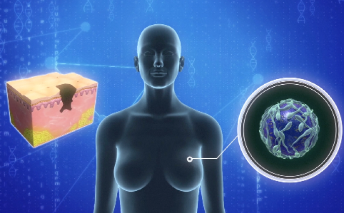 ศึกษาชี้ พนง.ต้อนรับบนเครื่องบินเสี่ยงโรคมะเร็ง