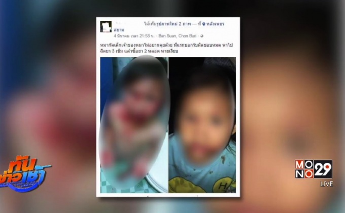 พ่อร้องลูกถูกหมากัดเย็บ 12เข็ม เจ้าของปัดความรับผิดชอบ