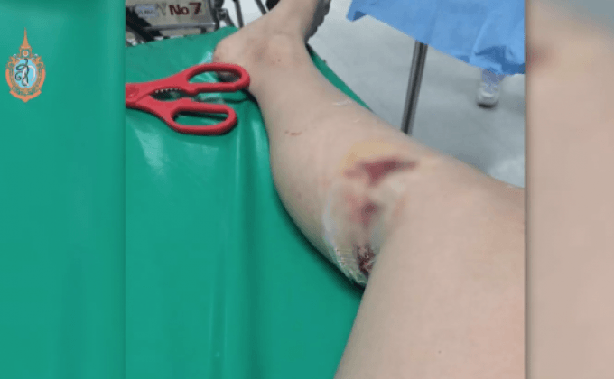 รปภ.บุกห้องพักหอหญิง จ.ปทุมธานี