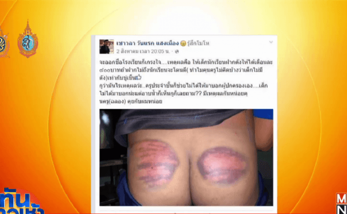 ญาติโวยเด็กถูกตีก้นจนช้ำ เหตุออมเงินไม่เข้าเป้า