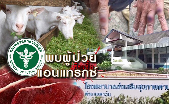 พบผู้ป่วยติดเชื้อแอนแทรกซ์