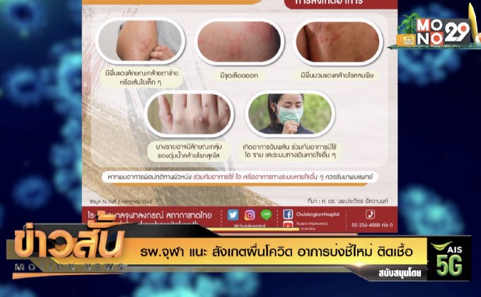รพ.จุฬา แนะ สังเกตผื่นโควิด อาการบ่งชี้ใหม่ ติดเชื้อ