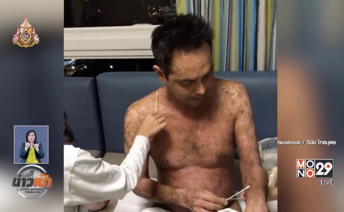 “เมฆ” วินัย ไกรบุตร กลับบ้านแล้ว