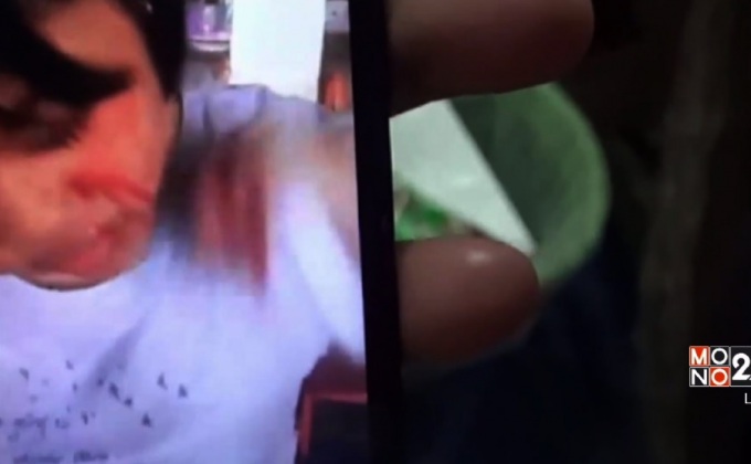 เด็กวัย 14 ปีอาการประหลาดเหงื่อไหลเป็นเลือด