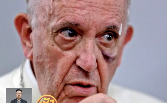 โป๊ปบาดเจ็บพระพักตร์ระหว่างเยือนโคลอมเบีย