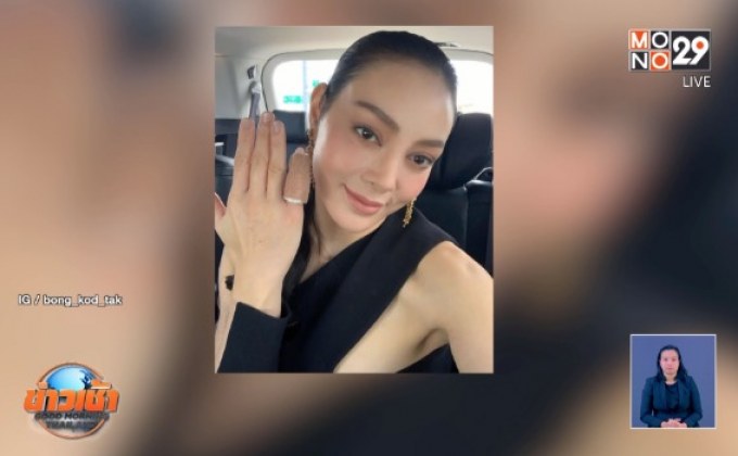 “ตั๊ก บงกช” อัพเดทอาการ หลังผ่าตัดแก้ไขนิ้วก้อยคดงอ