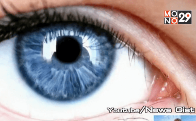 สีตาอาจเกี่ยวข้องกับการติดแอลกอฮอล์