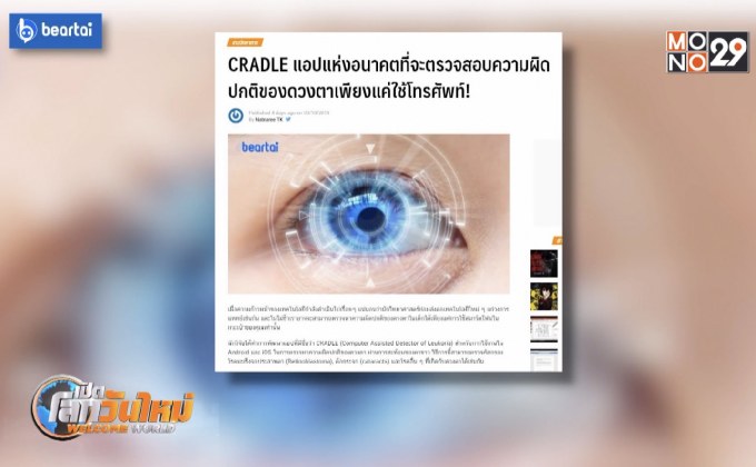 CRADLE แอปตรวจความผิดปกติของดวงตาโดยใช้โทรศัพท์