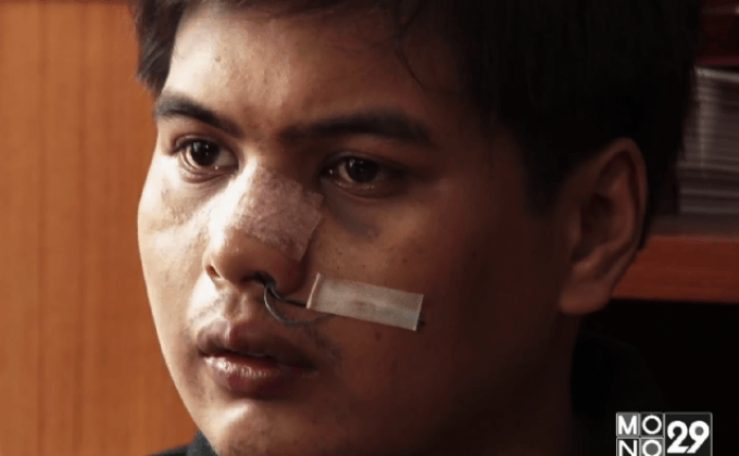 เหยื่อ “กราบรถ” ยื่นหลักฐานแพทย์ยืนยันถูกทำร้ายสาหัส