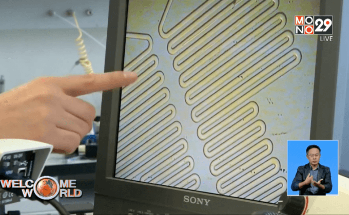 อุปกรณ์แยกประเภทมะเร็ง