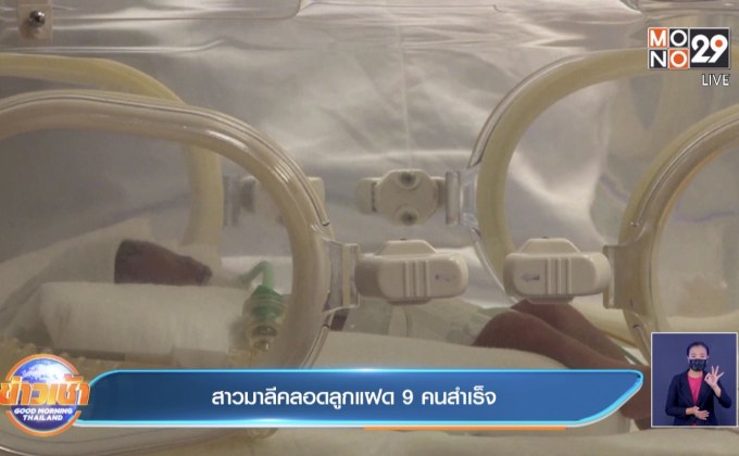 สาวมาลีคลอดลูกแฝด 9 คนสำเร็จ