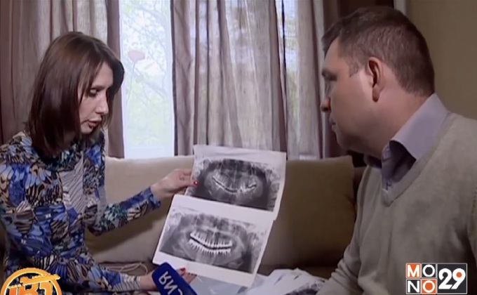 ทันตแพทย์รัสเซียถอนฟันดีของคนไข้ 22 ซี่