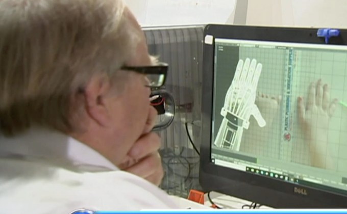 เปลี่ยนฝาขวดพลาสติกเป็นแขน-ขาเทียมให้เด็กพิการ