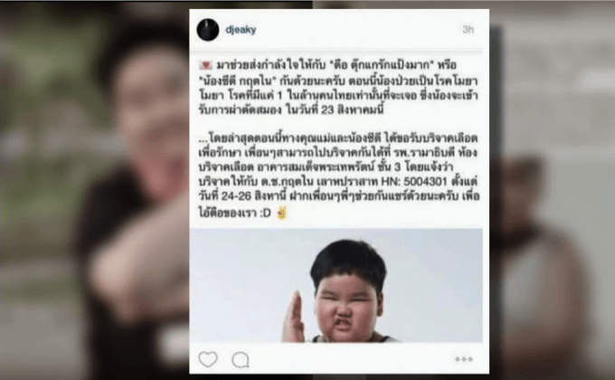 โรคโมยาโมยา