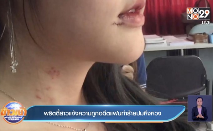 พริตตี้สาวแจ้งความถูกอดีตแฟนทำร้ายปมหึงหวง