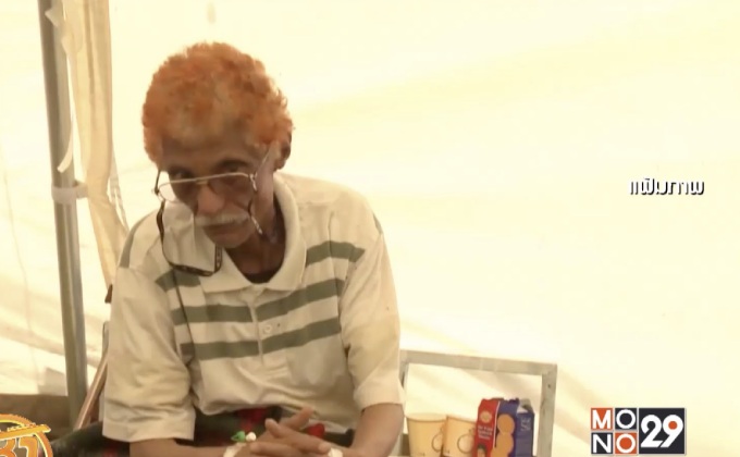 ยอดผู้ป่วยอหิวาตกโรคในเยเมนทะลุ 2 แสนราย