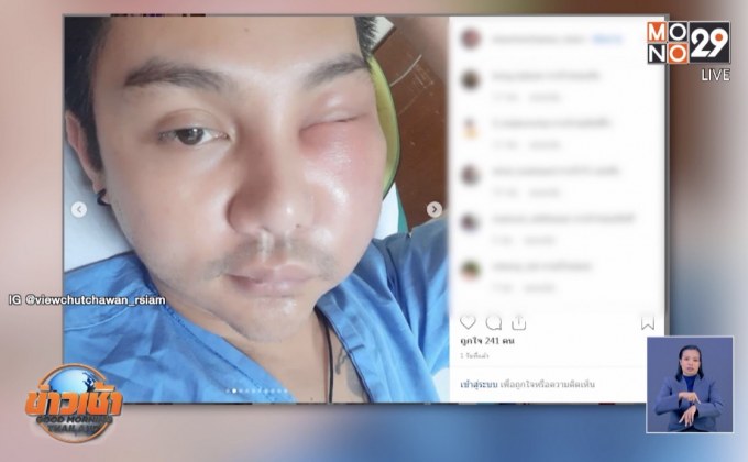 นักร้องลูกทุ่งแฉอาหารทะเลแชร์ฟอร์มาลีน