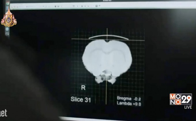 บริษัท “อีลอน มัสก์” เปิดตัวระบบเชื่อมสมองคน-คอมพิวเตอร์