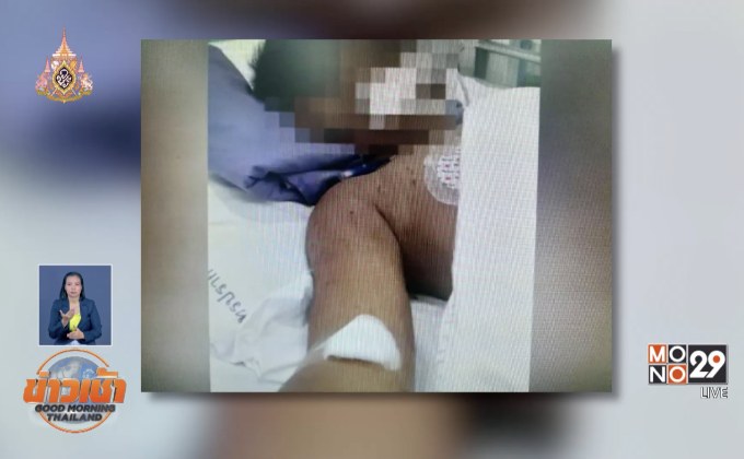 ล่าพี่เลี้ยงโหด ทำร้ายเด็ก 2 ขวบ ปางตาย