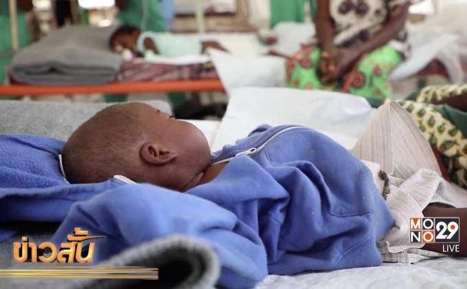 ​คองโกกำลังเผชิญกับการระบาดของโรคหัดอย่างรุนแรง