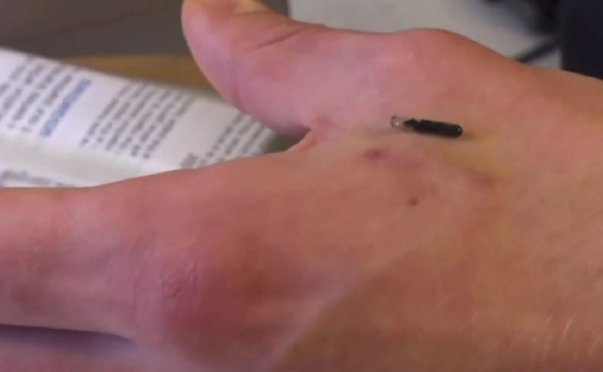 ฝังชิปข้อมูลในตัวคนใช้แทนบัตรและกุญแจ