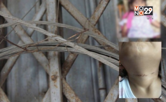 สายสลิงเกี่ยวคอเด็ก 4  ขวบบาดเจ็บ จ.ตรัง