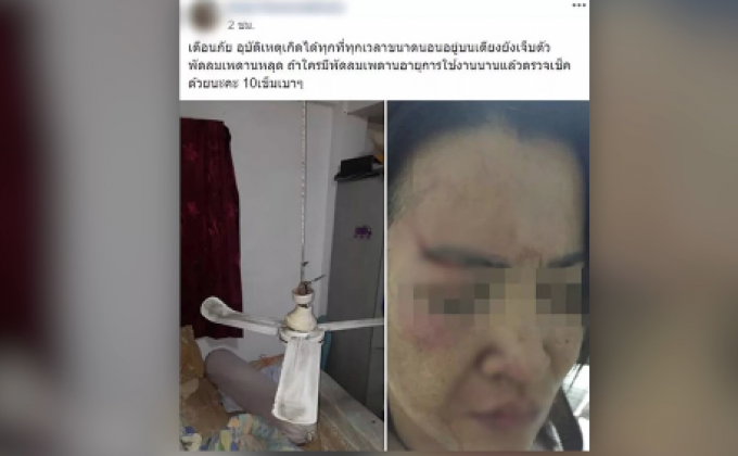 เตือนภัยพัดลมเพดานหลุดใส่หน้าขณะหลับ เย็บ 10 เข็ม