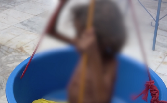 เด็กเยเมนเผชิญความอดอยากกว่า 5 ล้านคน