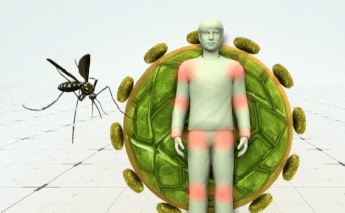 ไวรัสซิการะบาดทั่วทวีปอเมริกา