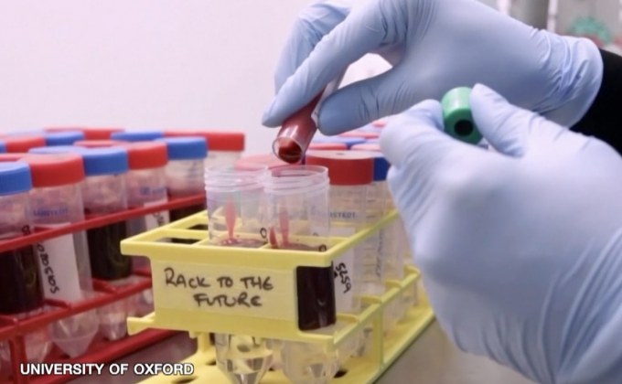 สถานการณ์ไวรัสโควิด-19 ในต่างประเทศ 19-09-63