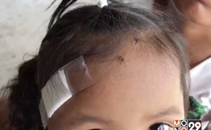 ร้องขอความเป็นธรรมลูกสาวถูกสุนัขกัด