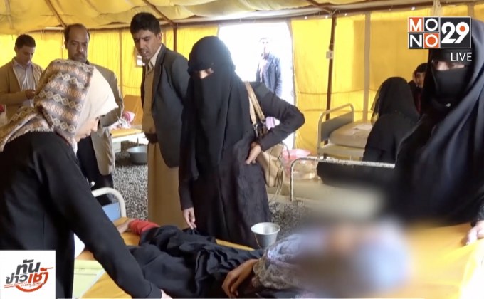 เตือนอหิวาตกโรคในเยเมนระบาดรุนแรง