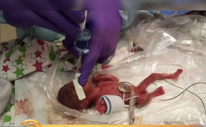 ​ทารกหญิงที่ตัวเล็กที่สุดในโลก