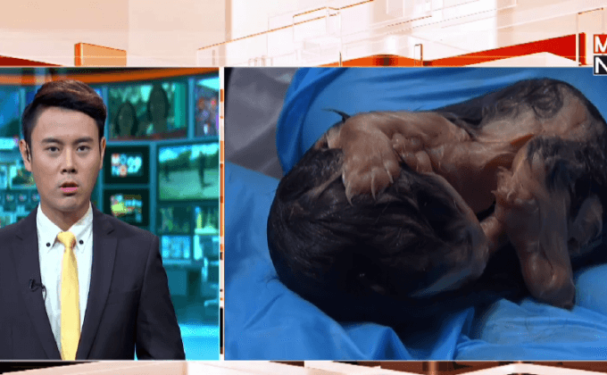 ประท้วงเรื่องสิทธิสัตว์ในชิลี