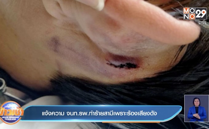 แจ้งความ จนท.รพ.ทำร้ายสามีเพราะร้องเสียงดัง