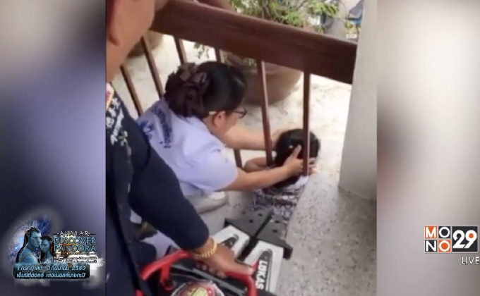 เด็กหญิง 5 ขวบหัวติดลูกกรงระเบียงโรงพยาบาล