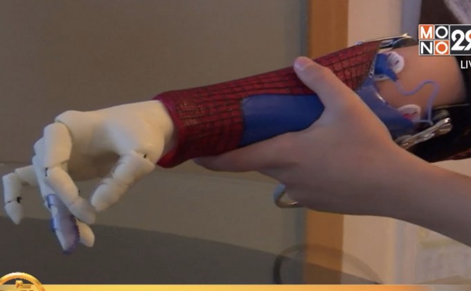 แขนเทียม 3D สไปเดอร์-แมนเพื่อเด็กพิการ