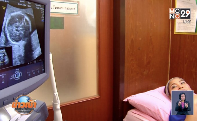 ดีเดย์บ่ายนี้! เริ่มจ่ายเงินอุดหนุนเด็กแรกเกิด – 6 ขวบ