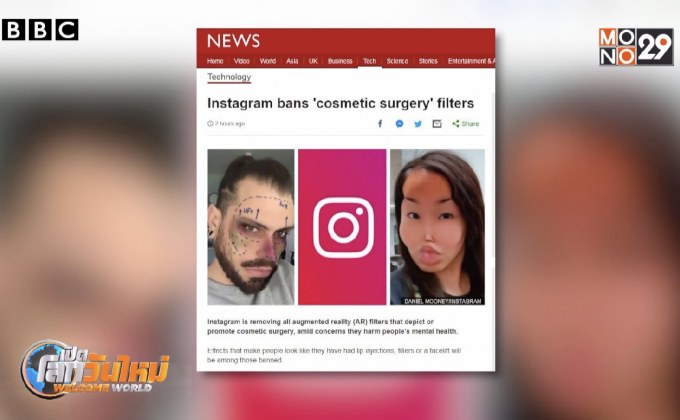 อินสตาแกรม แบนฟิลเตอร์ “ศัลยกรรมหน้า”