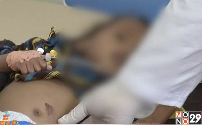 อหิวาตกโรคคร่าชีวิตชาวเยเมนแล้ว 1,500 คน