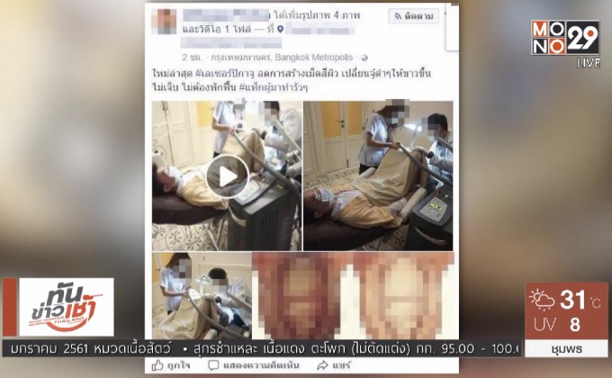รพ.แจงกรณีเลเซอร์อวัยวะเพศให้ขาว