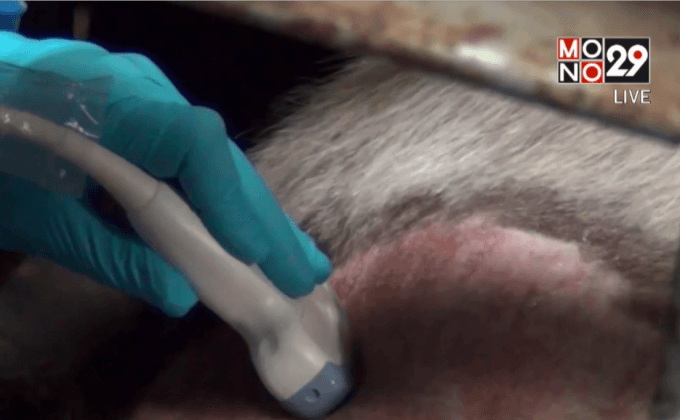 พบสัญญาณชีพจรการตั้งท้อง “หลินฮุ่ย”