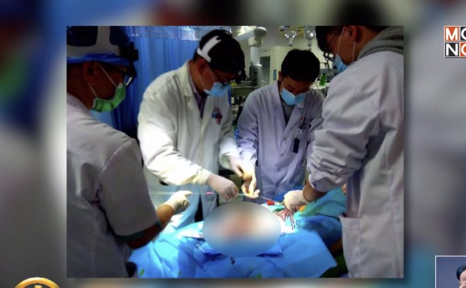 แพทย์จีนปลุกชีพคนไข้หัวใจหยุดเต้นนาน 72 ชั่วโมง