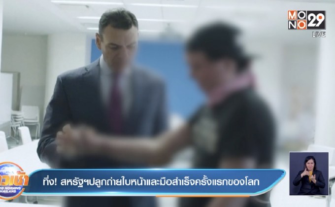 ​ทึ่ง! สหรัฐปลูกถ่ายใบหน้าและมือสำเร็จครั้งแรกของโลก